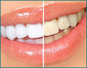 Estetica-dental