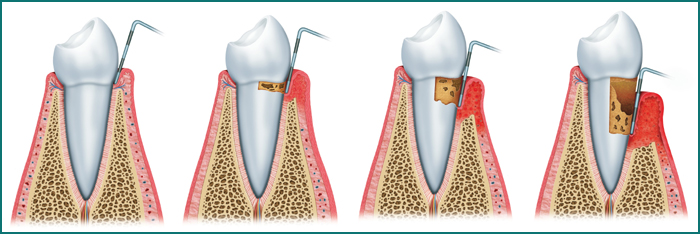 periodoncia